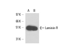 Laminin-R (H-2): sc-74515. Western blot analysis of Laminin-R expression in non-transfected: sc-117752 (A) and human Laminin-R transfected: sc-113628 (B) 293T whole cell lysates.