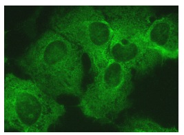 Laminin-R (H-2): sc-74515. Immunofluorescence staining of formalin-fixed Hep G2 cells showing cytoplasmic localization.