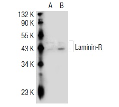 Laminin-R (MLuC5): sc-59732. Western blot analysis of Laminin-R expression in non-transfected: sc-117752 (A) and human Laminin-R transfected: sc-116343 (B) 293T whole cell lysates.