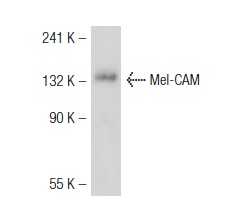Mel-CAM (C-20): sc-18942. Western blot analysis of Mel-CAM expression in HeLa whole cell lysate.