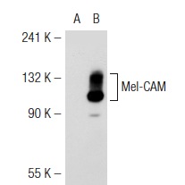 Mel-CAM (C-20): sc-18942. Western blot analysis of Mel-CAM expression in non-transfected: sc-117752 (A) and mouse Mel-CAM transfected: sc-121599 (B) 293T whole cell lysates.