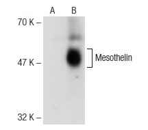 Mesothelin (H-280): sc-50426. Western blot analysis of Mesothelin expression in non-transfected: sc-117752 (A) and human Mesothelin transfected: sc-171058 (B) 293T whole cell lysates.