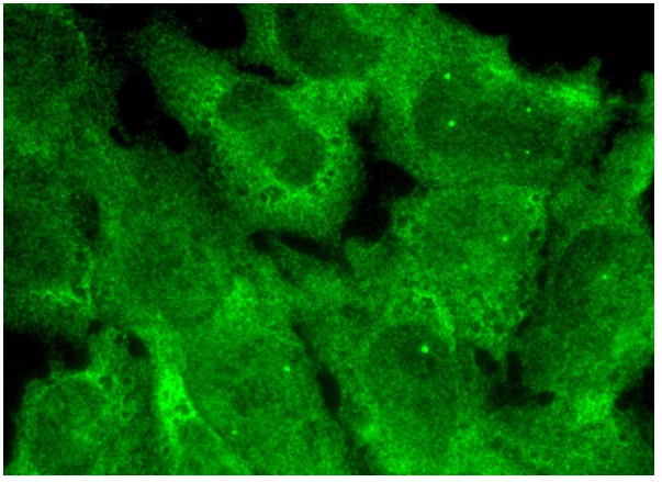 Gemin2 (E-7): sc-166162. Immunofluorescence staining of formalin-fixed HepG2 cells showing nuclear and cytoplasmic localization.