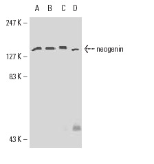 neogenin (H-175): sc-15337. Western blot analysis of neogenin expression in HeLa (A), Ca Ski (B), T84 (C) and A549 (D) whole cell lysates.
