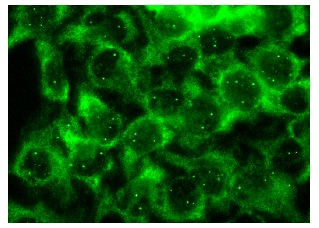Gemin4 (E-8): sc-365424. Immunofluorescence staining of methanol-fixed HeLa cells showing cytoplasmic localization.