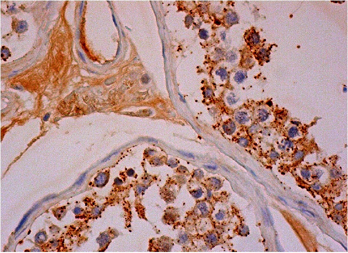 Gemin4 (E-8): sc-365424. Immunoperoxidase staining of formalin fixed, paraffin-embedded human testis tissue showing cytoplasmic staining of cells in seminiferous ducts and Leydig cells.