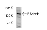 P-Selectin (CTB201): sc-8419. Western blot analysis of P-Selectin expression in WEHI-231 whole cell lysate.