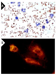 P-Selectin (M-20): sc-6943. Immunoperoxidase staining of formalin-fixed human platelets and white blood cells showing membrane staining of platelets (A). Rhodamine immunofluorescence staining of methanol-fixed HUV-EC-C cells showing membrane localization (B).