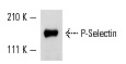 P-Selectin (M-20): sc-6943. Western blot analysis of P-Selectin expression in human platelet extract.