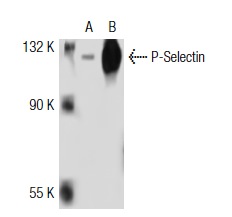P-Selectin (M-20): sc-6943. Western blot analysis of P-Selectin expression in non-transfected: sc-117752 (A) and human P-Selectin transfected: sc-114655 (B) 293T whole cell lysates.
