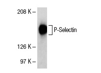 P-Selectin (1 E 3): sc-19672. Western blot analysis of P-Selectin expression in human platelet extract.