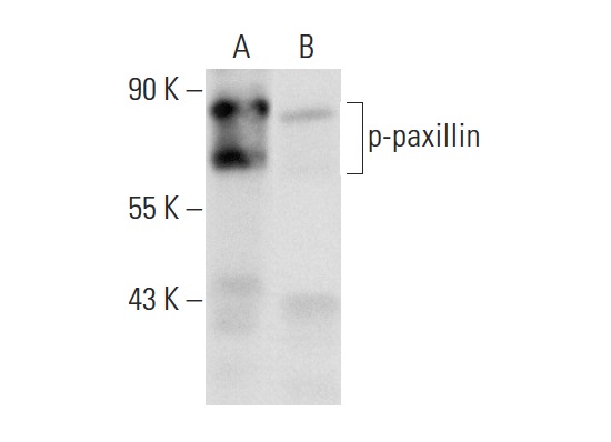 p-paxillin (Tyr 118)-R: sc-14036-R. Western blot analysis of paxillin phosphorylation in untreated (A) and lambda protein phosphatase treated (B) A-431 whole cell lysates.
