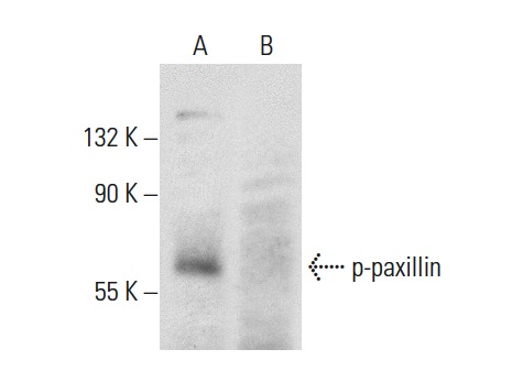 p-paxillin (Tyr 118): sc-14036. Western blot analysis of paxillin phosphorylation in untreated (A) and lambda protein phosphatase treated (B) A-431 whole cell lysates.