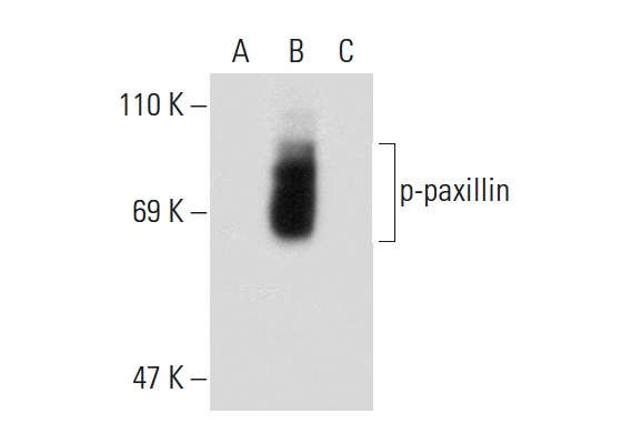p-paxillin (Tyr 118): sc-101774. Western blot analysis of paxillin phosphorylation in untreated (A), pervanadate treated (B) and pervanadate and lambda protein phosphatase (sc-200312A) treated (C) A-431 whole cell lysates.