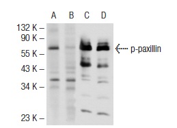 Western blot analysis of paxillin phosphorylation in untreated (A, C) and lambda protein phosphatase treated (B, D) HeLa whole cell lysates. Antibodies tested include p-paxillin (Tyr 118): sc-101774 (A, B) and paxillin (H-114): sc-5574 (C, D).