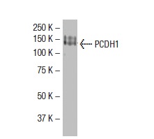 PCDH1 (S-6): sc-81816. Western blot analysis of PCDH1 expression in A-431 whole cell lysate.