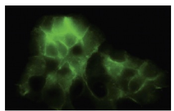 PCDH1 (S-6): sc-81816. Immunofluorescence staining of paraformaldehyde-fixed A-431 cells showing membrane and cytoplasmic localization.