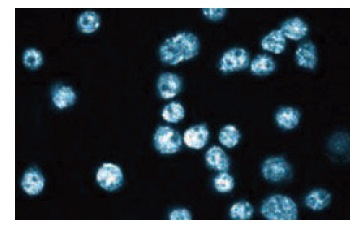 plakophilin 2 (28): sc-136039. Immunofluorescence staining of HeLa cells showing nuclear and cytoplasmic localization.