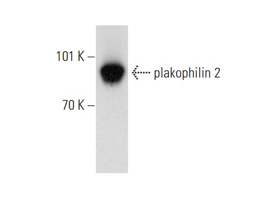 plakophilin 2 (28): sc-136039. Western blot analysis of plakophilin 2 expression in Caco-2 whole cell lysate.