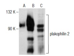 plakophilin 2 (28): sc-136039. Western blot analysis of plakophilin 2 expression in non-transfected: sc-117752 (A) and human plakophilin 2 transfected: sc-372976 (B) 293T whole cell lysates and HeLa nuclear extract (C).