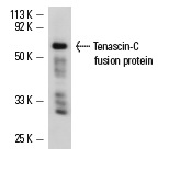 Tenascin-C (E-9): sc-25328. Western blot analysis of human recombinant Tenascin-C fusion protein.