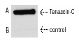 Slot blot analysis of purified humanTenascin-C (A) and secondary control (B). Antibodies tested include Tenascin-C (300-3): sc-13578 (A) and secondary control goat anti-mouse IgG-HRP: sc-2005 (B).