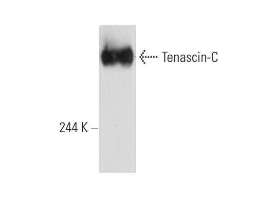 Tenascin-C (300-3): sc-13578. Western blot analysis of purified human Tenascin-C.
