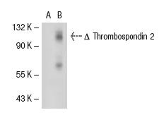 Thrombospondin 1/2 (D-9): sc-74538. Western blot analysis of Thrombospondin 2 expression in non-transfected: sc-117752 (A) and truncated human Thrombospondin 2 transfected: sc-112804 (B) 293T whole cell lysates.