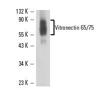 Vitronectin 65/75 (B-1): sc-74485. Western blot analysis of purified human Vitronectin.