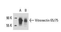 Vitronectin 65/75 (B-1): sc-74485. Western blot analysis of Vitronectin 65/75 expression in A549 (A) and HeLa (B) whole cell lysates.