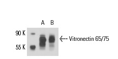 Vitronectin 65/75 (D-8): sc-74484. Western blot analysis of Vitronectin 65/75 expression in A549 (A) and HeLa (B) whole cell lysates.