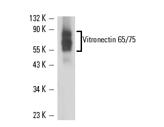 Vitronectin 65/75 (D-8): sc-74484. Western blot analysis of purified human Vitronectin.