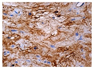 Vitronectin 65/75 (D-8): sc-74484. Immunoperoxidase staining of formalin fixed, paraffin-embedded human kidney tissue showing extracellular matrix staining.