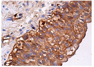 Vitronectin 65/75 (D-8): sc-74484. Immunoperoxidase staining of formalin fixed, paraffin-embedded human kidney tissue showing cytoplasmic staining of urothelial cells.