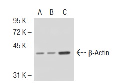 Actin (I-19): sc-1616. Western blot analysis of β-Actin expression in non-transfected 293T: sc-117752 (A), human β-Actin transfected 293T: sc-111134 (B) and C32 (C) whole cell lysates.