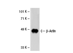 β-Actin (C4): sc-47778. Western blot analysis of β-Actin expression in A-10 whole cell lysate.