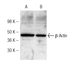 β-Actin (N-21): sc-130656. Western blot analysis of β-Actin expression in Jurkat whole cell lystate (A) and mouse intestine tissue extract (B).