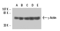 γ-Actin (2-4): sc-65634. Western blot analysis of γ-Actin expression in HeLa (A), C32 (B), Sol8 (C), KNRK (D) and NIH/3T3 (E) whole cell lysates.