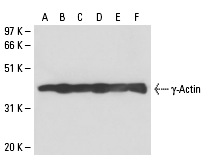γ-Actin (2-24): sc-65635. Western blot analysis of γ-Actin expression in HeLa (A), C32 (B), L6 (C), KNRK (D), NIH/3T3 (E) and A-431 (F) whole cell lysates.