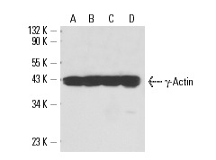 γ-Actin (2-2): sc-65636. Western blot analysis of γ-Actin expression in HeLa (A), C32 (B), Sol8 (C) and NIH/3T3 (D) whole cell lysates.