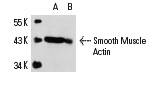 Smooth Muscle Actin (CGA7): sc-53015. Western blot analysis of Smooth Muscle Actin expression in A-10 whole cell lysate under reducing (A) and non-reducing (B) conditions.