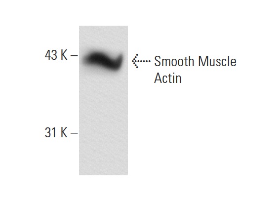 Smooth Muscle Actin (CGA7): sc-53015. Western blot analysis of Smooth Muscle Actin expression in HeLa whole cell lysate.