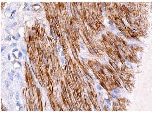 Smooth Muscle Actin (CGA7): sc-53015. Immunoperox-idase staining of formalin fixed, paraffin-embedded human smooth muscle tissue showing cytoskeletal staining of smooth muscle cells.