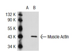 Muscle Actin (4i346): sc-71625. Western blot analysis of ACTG2 expression in non-transfected: sc-117752 (A) and mouse ACTG2 transfected: sc-118229 (B) 293T whole cell lysates.