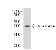Muscle Actin (5G2): sc-71626. Western blot analysis of Muscle Actin expression in A-10 whole cell lysate.