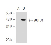 Muscle Actin (5G2): sc-71626. Western blot analysis of ACTC1 expression in non-transfected: sc-117752 (A) and human ACTC1 transfected: sc-126392 (B) 293T whole cell lysates.