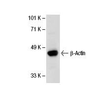 β-Actin (ACTBD11B7): sc-81178. Western blot analysis of β-Actin expression in A-10 whole cell lysate.