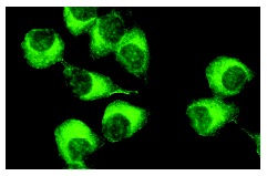 Arp2 (H-84): sc-15389. Immunofluorescence staining of methanol-fixed KNRK cells showing cytoplasmic localization.