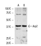 Arp2 (H-84): sc-15389. Western blot analysis of Arp2 expression in C32 (A) and KNRK (B) whole cell lysates.