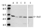 Western blot analysis of Arp3 expression in KNRK (A,E), HeLa (B), NIH/3T3 (C) and C32 (D) whole cell lysates. Antibodies tested include Arp3 (C-16): sc-10132 (A-D) and Arp3 (G-15): sc-10130 (E).